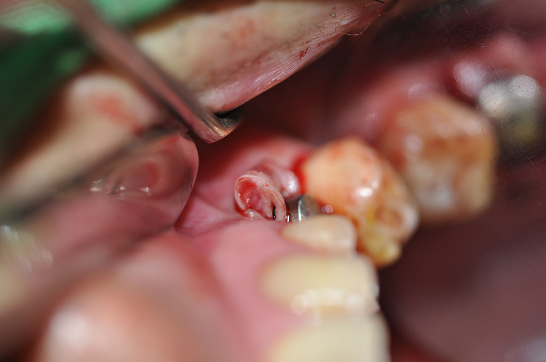%_tempFileNameImplant%20129c5%