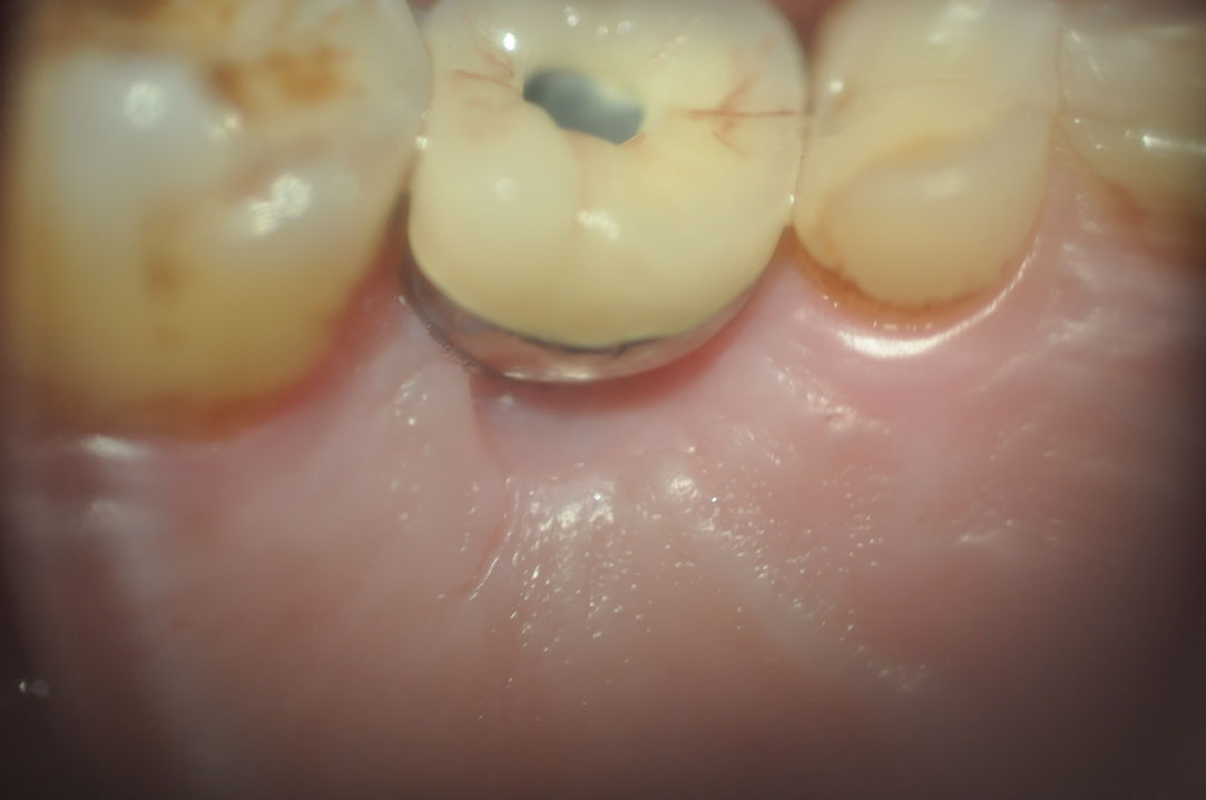 %_tempFileNameImplant%20129c8%