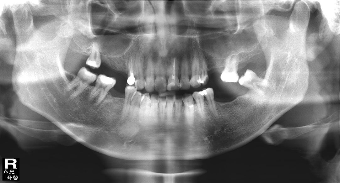 %_tempFileNameImplant%20129e1%