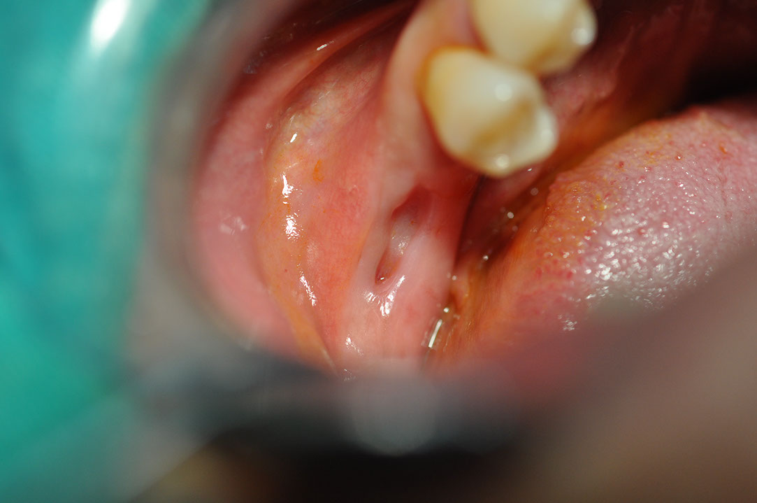 %_tempFileNameImplant%20130a2%