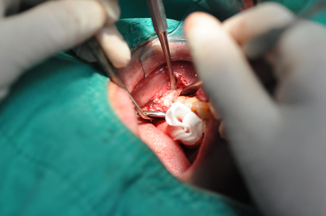 %_tempFileNameImplant%20130a7%