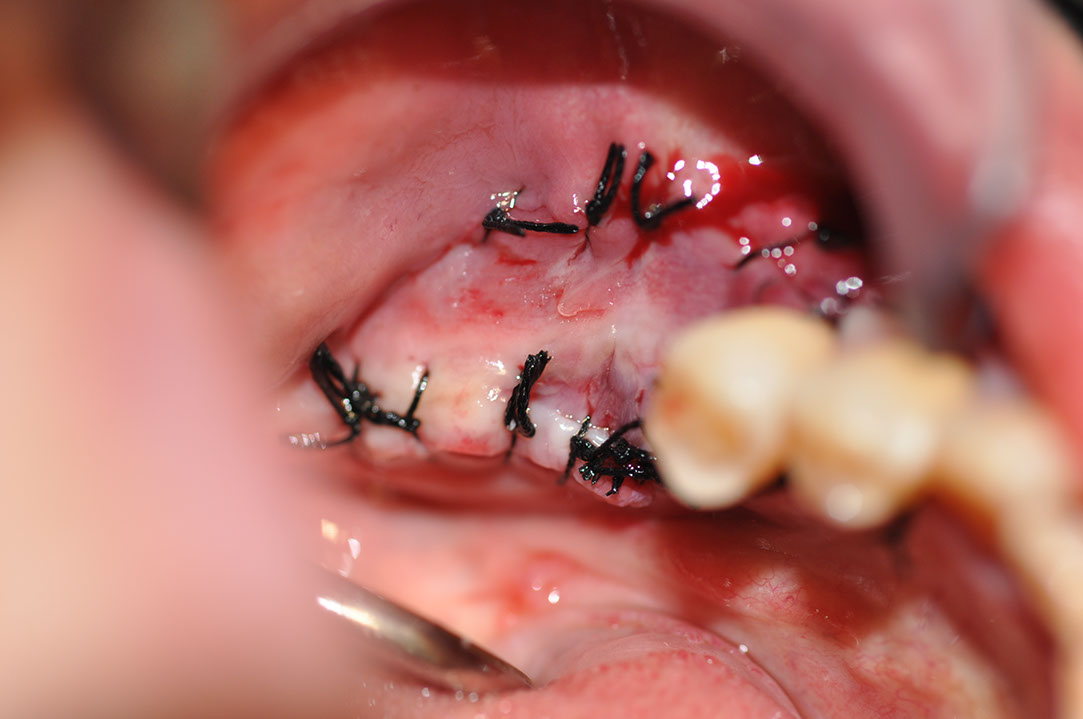 %_tempFileNameImplant%20130a9%