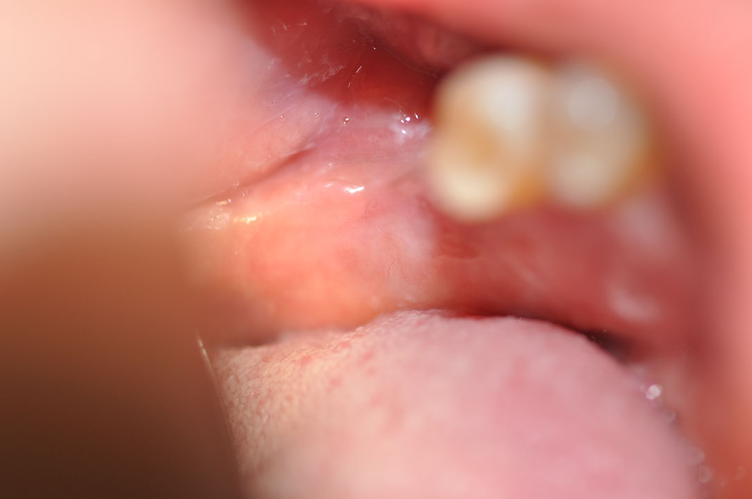%_tempFileNameImplant%20130b2%