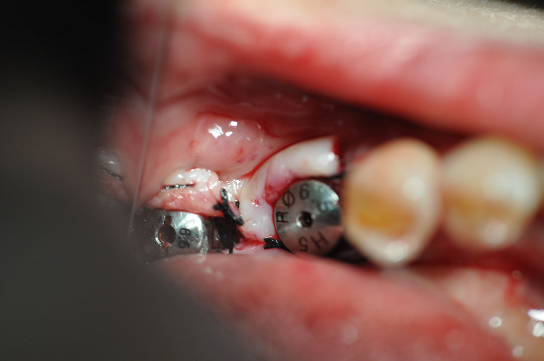%_tempFileNameImplant%20130b3%