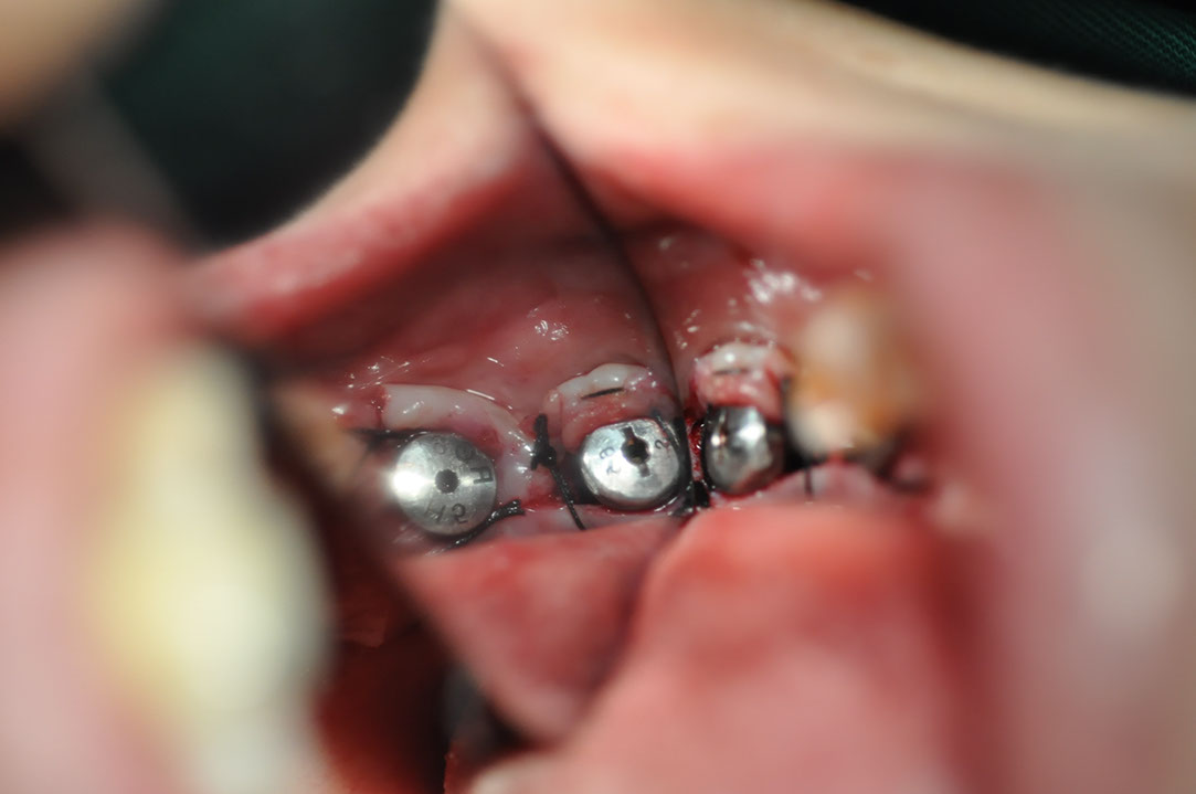%_tempFileNameImplant%20130b4%