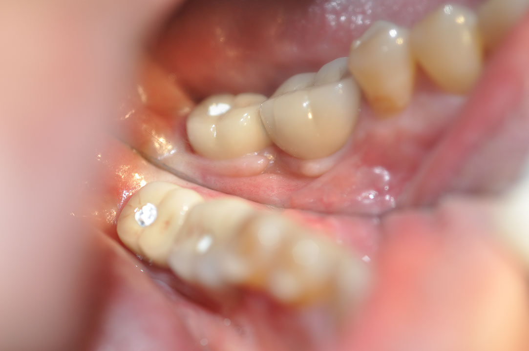 %_tempFileNameImplant%20130b6%
