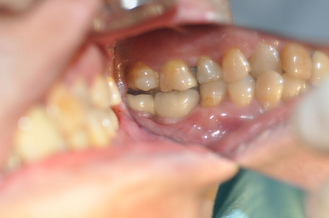 %_tempFileNameImplant%20130b7%