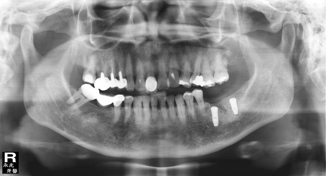 %_tempFileNameImplant%20130c3%