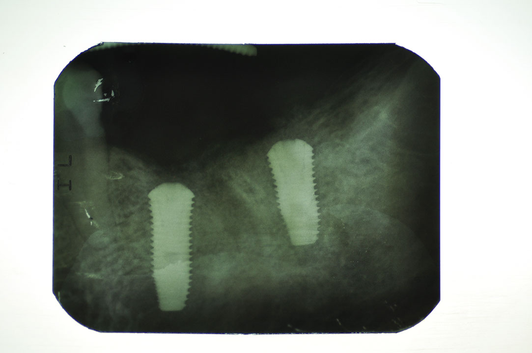 %_tempFileNameImplant%20130c4%