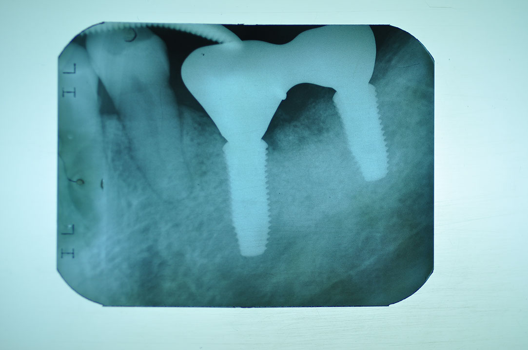 %_tempFileNameImplant%20130c5%