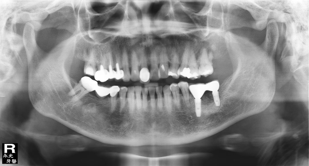 %_tempFileNameImplant%20130c6%