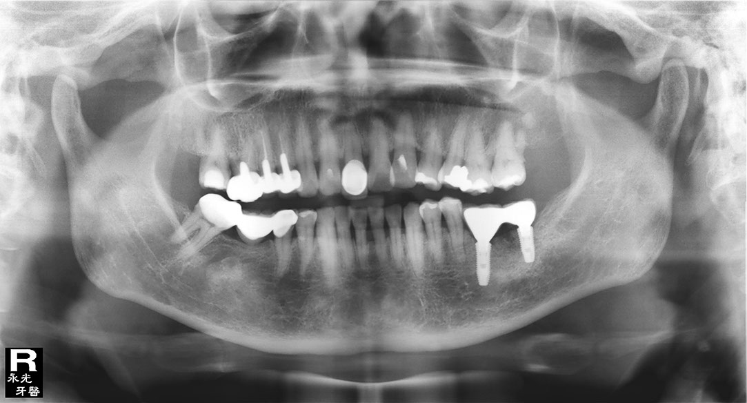 %_tempFileNameImplant%20130c7%