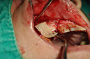 %_tempFileNameImplant%20120b7%