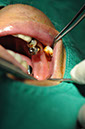 %_tempFileNameImplant%20123a4%