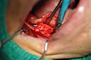 %_tempFileNameImplant%20123a5%