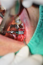 %_tempFileNameImplant%20123a6%