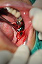 %_tempFileNameImplant%20123a7%