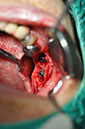 %_tempFileNameImplant%20123b2%