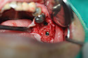 %_tempFileNameImplant%20123b3%