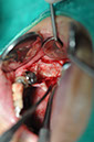 %_tempFileNameImplant%20123b4%