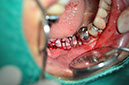 %_tempFileNameImplant%20123b6%