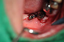 %_tempFileNameImplant%20123b8%