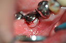 %_tempFileNameImplant%20123b9%
