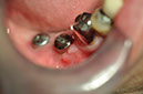 %_tempFileNameImplant%20123c1%