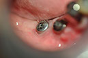%_tempFileNameImplant%20123c2%
