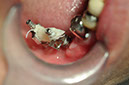 %_tempFileNameImplant%20123c3%
