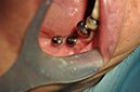 %_tempFileNameImplant%20123c7%