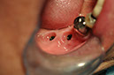 %_tempFileNameImplant%20123c8%