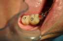 %_tempFileNameImplant%20123d1%