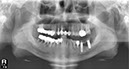 %_tempFileNameImplant%20123d2%