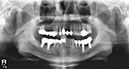 %_tempFileNameImplant%20123d3%