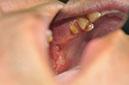 %_tempFileNameImplant%20124a1%
