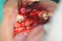 %_tempFileNameImplant%20124a2%