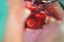 %_tempFileNameImplant%20124a3%