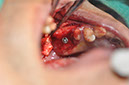 %_tempFileNameImplant%20124a5%