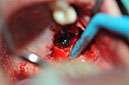 %_tempFileNameImplant%20124a9%
