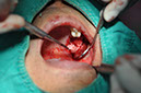%_tempFileNameImplant%20124b1%