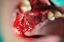 %_tempFileNameImplant%20124b2%