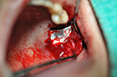 %_tempFileNameImplant%20124b3%