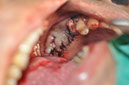 %_tempFileNameImplant%20124b6%