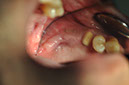 %_tempFileNameImplant%20124b7%
