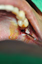 %_tempFileNameImplant%20124b8%
