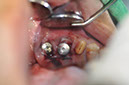 %_tempFileNameImplant%20124c1%