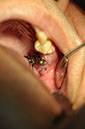 %_tempFileNameImplant%20124c2%