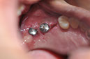 %_tempFileNameImplant%20124c3%