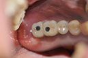%_tempFileNameImplant%20124c5%